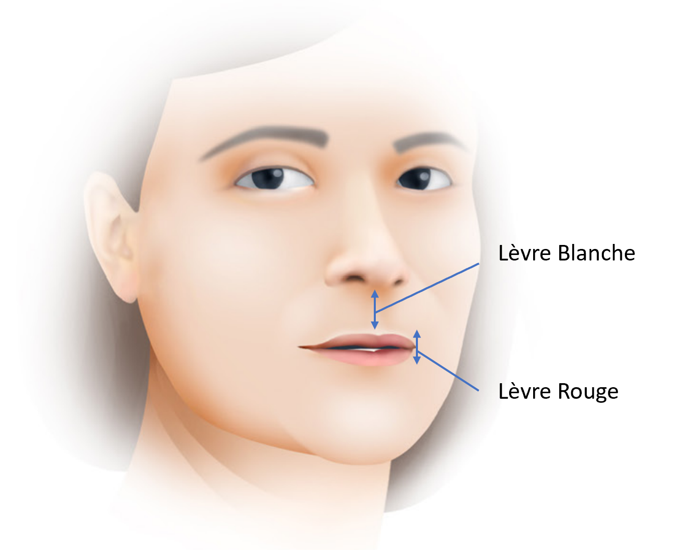 Lifting de la Lèvre Supérieure Dr Yoni Madar, Spécialiste en Chirurgie.
