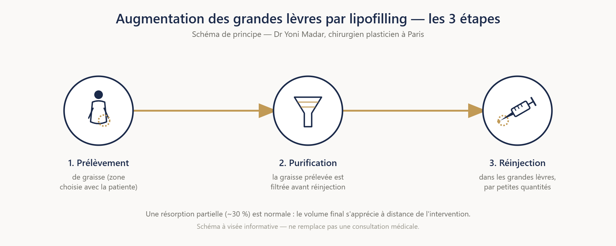 Schéma en 3 étapes : prélèvement, purification, réinjection